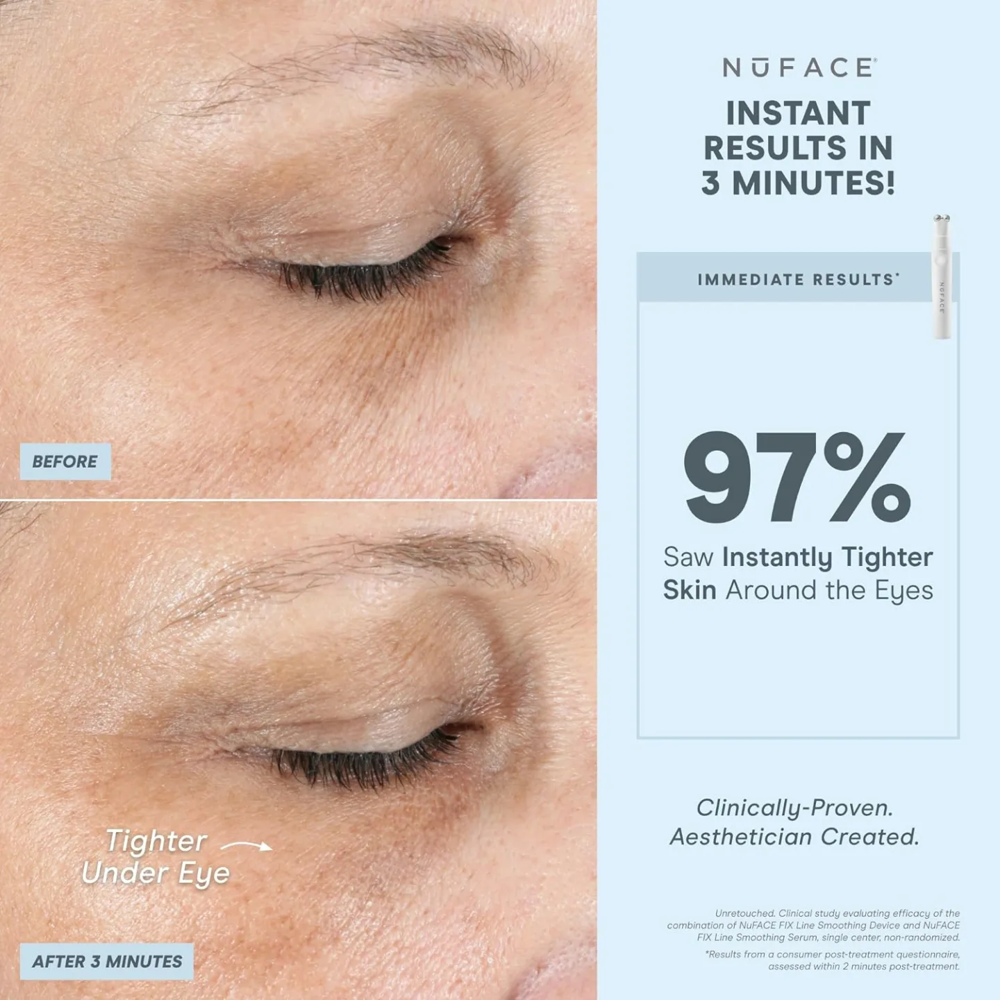 NuFACE Mini & FIX Starter Kit for Toning & Smoothing