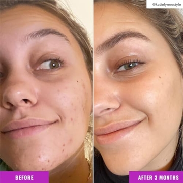 Good Molecules Niacinamide Brightening Toner for Radiant Skin