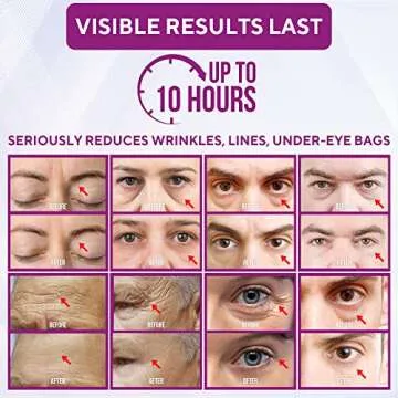 Everliving Skin Instant Firming & Tightening Eye Cream (12 ml) – Temporarily Reduces Under-Eye Bags, Puffiness, Wrinkles & Fine Lines for a Youthful Appearance with Results Lasting 8 Hours