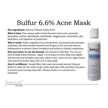Sulfur Acne Mask - Sulfur 6.6% Drying lotion for Acne