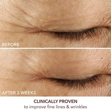 Dr. Dennis Gross Eye Serum for Firm Skin & Hydration