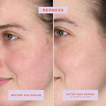 Tower 28 SOS Intensive Rescue Serum for Sensitive Skin, Hypochlorous Acid Skin Care, Soothes Irritation, Helps Reduce Face Redness, Safe for All Skin Types, 2 FL Oz