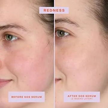 Tower 28 SOS Intensive Rescue Serum for Sensitive Skin, Hypochlorous Acid Skin Care, Soothes Irritation, Helps Reduce Face Redness, Safe for All Skin Types, 2 FL Oz