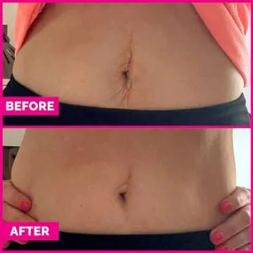Tummy Sleek - Firming Serum for Tighter Belly Skin