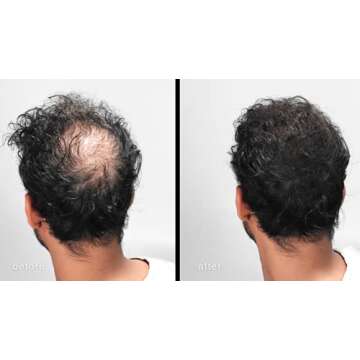 LUXE Hair Thickening Fibers - CONFIDENCE IN A JAR – 2 Months+ Supply! – Hypoallergenic, Dermatol...