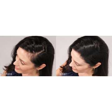 LUXE Hair Thickening Fibers - CONFIDENCE IN A JAR – 2 Months+ Supply! – Hypoallergenic, Dermatologist Tested – Multiple Colors Available (Dark Brown)