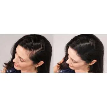 LUXE Hair Thickening Fibers - CONFIDENCE IN A JAR – 2 Months+ Supply! – Hypoallergenic, Dermatologist Tested – Multiple Colors Available (Dark Brown)