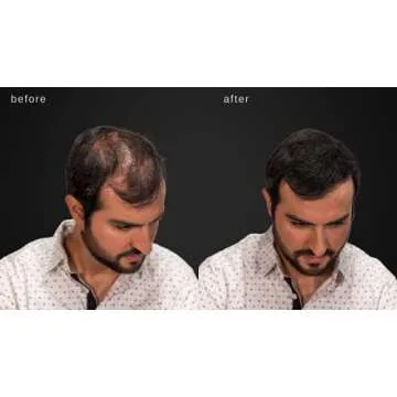 LUXE Hair Thickening Fibers - CONFIDENCE IN A JAR – 2 Months+ Supply! – Hypoallergenic, Dermatologist Tested – Multiple Colors Available (Dark Brown)