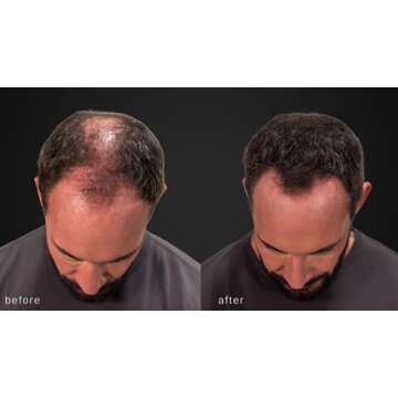 LUXE Hair Thickening Fibers - CONFIDENCE IN A JAR – 2 Months+ Supply! – Hypoallergenic, Dermatologist Tested – Multiple Colors Available (Dark Brown)