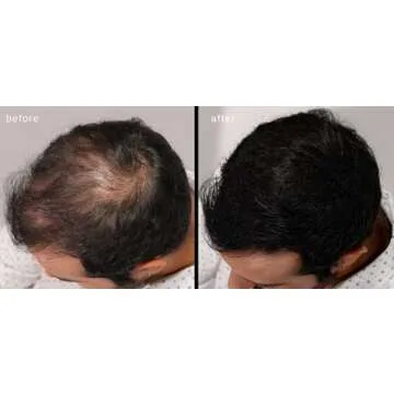 LUXE Hair Thickening Fibers - CONFIDENCE IN A JAR – 2 Months+ Supply! – Hypoallergenic, Dermatologist Tested – Multiple Colors Available (Dark Brown)