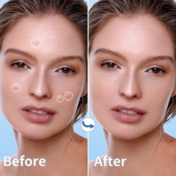 Daolyo Pimple Patches - Clear Skin Naturally, 300 Counts