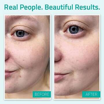 YEOUTH Pure Hyaluronic Acid Serum for Face 100% for Dry & Dull Skin, Hydrating Hyaluronic Face Serum for Women & Men, For All Skin Types 1oz