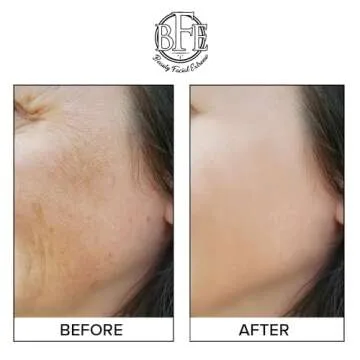 Revitalize Skin with Anti Aging Resurfacing Peel Pads