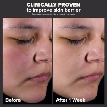 Paula's Choice 2% BHA Liquid Exfoliant for Radiant Skin