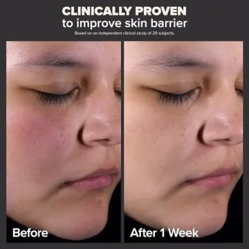 Paula's Choice 2% BHA Liquid Exfoliant for Radiant Skin