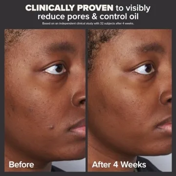 Paula's Choice 2% BHA Liquid Exfoliant for Radiant Skin