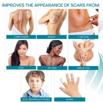 NewGel Plus Scar Gel: Advanced Treatment for All Scars