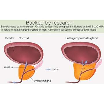 Pure Saw Palmetto Oil Organic Natural 60-90-day Supply Unlike Inefficient Powders Support Prostate Health Sleep Better Reduce Frequent Urination DHT Blocker Stop Hair Loss (1 Fl Oz)