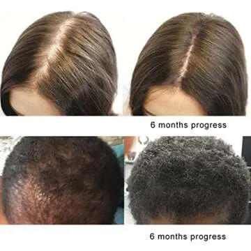 Pure Saw Palmetto Oil for Prostate Health and Hair Growth