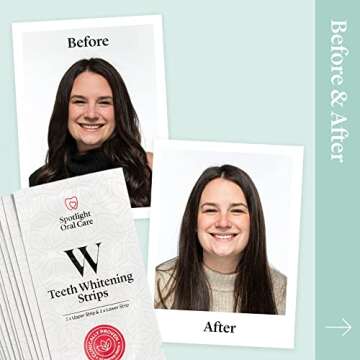 Spotlight Oral Care Whitening Strips for Bright Smiles