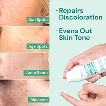 Ebanel Dark Spot Remover for Face Peel Skin Brightening Cream Melasma Hyperpigmentation Treatment Sun Spot Age Spots Freckle Remover Fade Cream, Synovea, 4-Butylresorcinol, Niacinamide, Glutathione