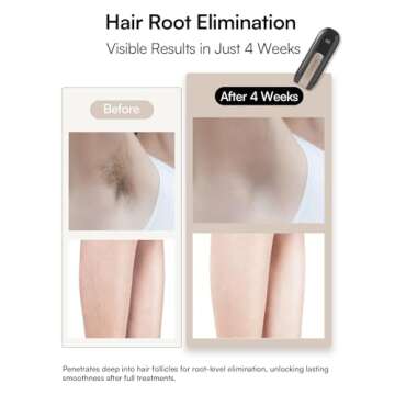 INIA Fond Hair Remover for Lasting Hair Reduction