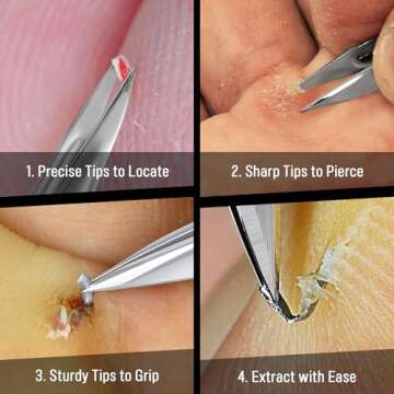 DUROX Splinter Remover - Pointy Tweezers for Cactus, Wood & Metal Splinter Removal