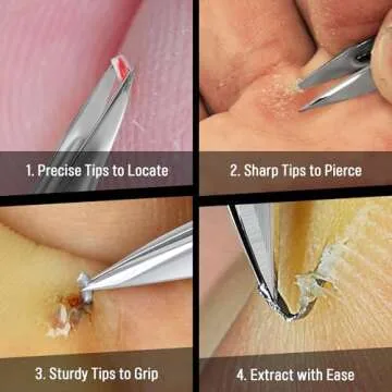 DUROX Splinter Remover - Pointy Tweezers for Cactus, Wood & Metal Splinter Removal