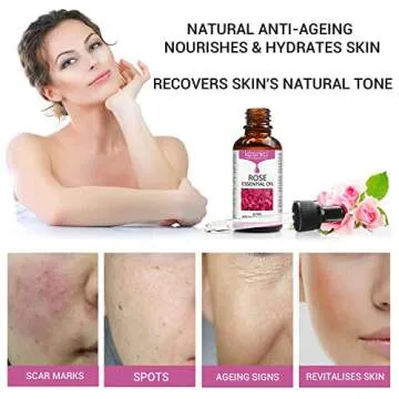 Rose Essential Oil, Face Rose Oil, Moisturizer Rose Oil, Anti Ageing & Anti Wrinkle Serum, Rose Oil for Face, Skin Care, 1 FL.OZ (30ml)