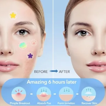 Pimple Patches for Face, Hydrocolloid Acne Patches, Pimple Patches for Blemishes and Zits, Pimple Patches Cute with Tea Tree Oil, Facial Sticker by Pimple Patches Stars (232pcs)