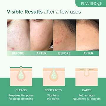 PLANTIFIQUE Korean Skin Care Detox Face Mask with Avocado & Superfoods - Hydrating Clay Mud Mask Der...