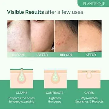 PLANTIFIQUE Korean Skin Care Detox Face Mask with Avocado & Superfoods - Hydrating Clay Mud Mask Der...