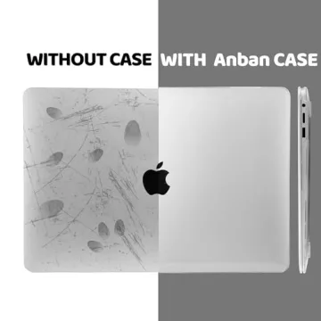 Anban Clear Hard Shell Case for MacBook Pro 13 inch