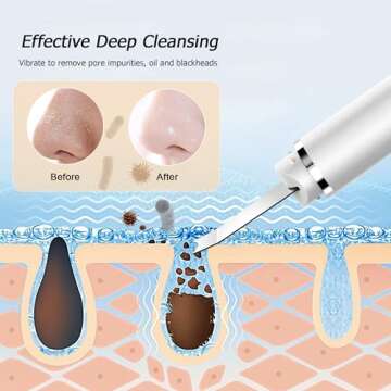 AIWOIT Scrubber for Skin Care Face Spatula Blackhead Remover Facial Deep Cleansing Black Head Removal Pore Cleaner Tools