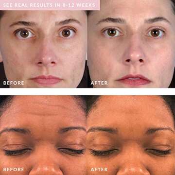 PMD Personal Microderm Beauty - Skincare for Sensitive Skin Bundle Set - Includes Personal Microderm Pro & Clean Blush - Microdermabrasion Machine & Smart Facial Cleansing Device for Vibrant Skin