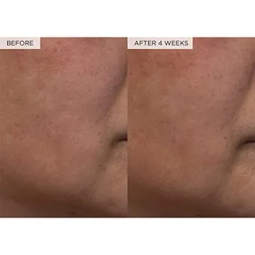 Hydrating Glow Recipe PHA + BHA Toner for All Skin Types