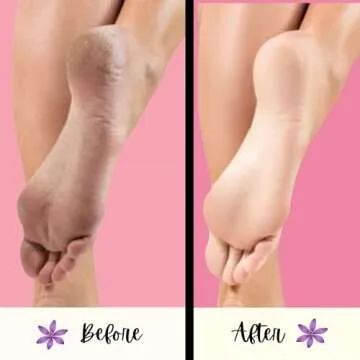 Mr. Pumice Callus Remover PUMI Bar: Pedicure Stone & Foot/Heel Scrubber - Coarse Grit (4 Pack)