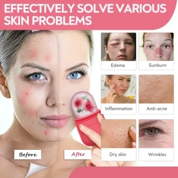 AURUZA Ice Face Roller and Gua Sha Set for Radiant Skin