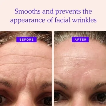 BLUMBODY Mini Face Wrinkle Patches - 160 Count for Youthful Skin