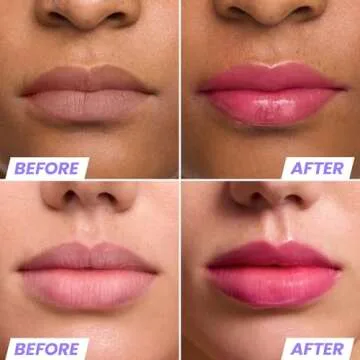 Wonderskin Lip Rehab Serum Oil - Color Changing Lip Oil from Clear to Pink - PH-activated, Non-stick...