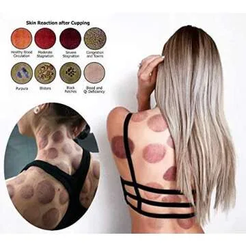 MUCHOO Cupping Set Professional Chinese Acupoint Cupping Therapy Sets Suction Hijama Cupping Set with Vacuum Magnetic Pump Cellulite Cupping Massage Kit 22-Cup