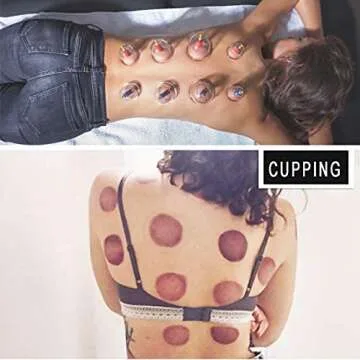 MUCHOO Cupping Set Professional Chinese Acupoint Cupping Therapy Sets Suction Hijama Cupping Set with Vacuum Magnetic Pump Cellulite Cupping Massage Kit 22-Cup