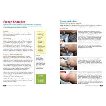 The Guide to Modern Cupping Therapy: Your Step-by-Step Source for Vacuum Therapy