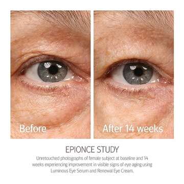 Epionce Renewal Eye Cream - Anti-Aging, Under Eye Cream for Dark Circles, Fine Lines, Wrinkles & Puffiness with Hyaluronic Acid, For All Skin Types, Dermatologist Skincare