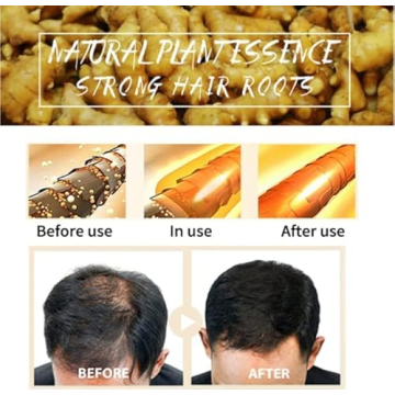 Ginger Hair Regrowth Shampoo Bars - Pack of 5 for Natural Hair Growth