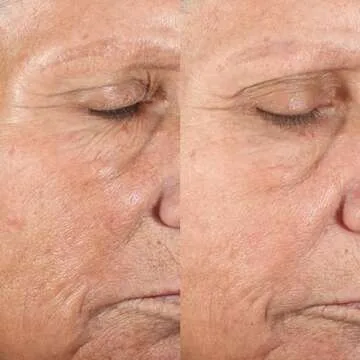 PMD Microderm Classic | Home Microdermabrasion Kit for Face | Exfoliating Crystals and Suction Help Circulation to Boost Collagen for Radiant Skin