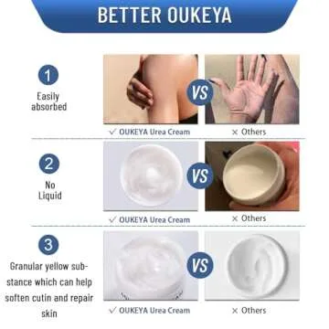 Effective OUKEYA Urea 40% Foot Cream for Dry Skin