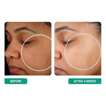 BeautyStat Probiotic 24HR Moisture Boost Cream - Made in the USA - Daily Moisturizer Face Cream with Probiotics, Ceramides, Hyaluronic Acid for Natural Anti Aging, Fine Lines, Wrinkles (1.7oz / 50ml)