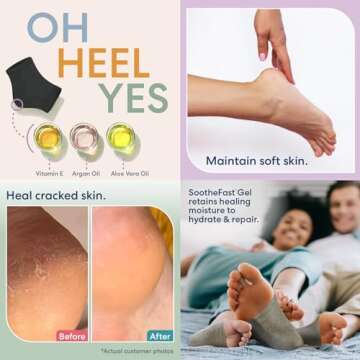 Dr. Frederick's Original Moisturizing Heel Socks for Cracked Heel Treatment - 2 Pairs - Socks for Dr...