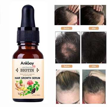 Cristalbox Hair Growth Serum,2020 Hair Growth Oil,Hair Growth,Stops Hair Loss, Hair Thinning Treatment, Hair Growth Treatment,Hair Serum, Thinning,Balding,And Promotes Hair Regrowth For Women and Men